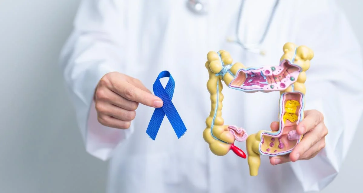 Colorectal Cancer: A Simple Test That Could Save Your Life at 50